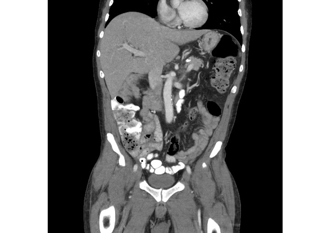 Abdominal Imaging | Department of Radiology | The University of