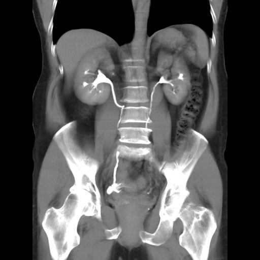 Abdominal Imaging Modalities | Department of Radiology | The