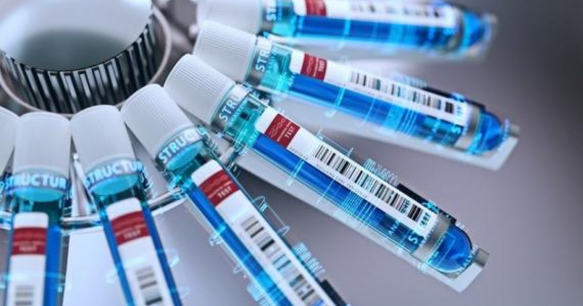 Dr Giger developed technology, QuantX, acquired by Paragon Biosciences